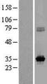 KCNRG Protein - Western validation with an anti-DDK antibody * L: Control HEK293 lysate R: Over-expression lysate