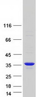 KCNRG Protein - Purified recombinant protein KCNRG was analyzed by SDS-PAGE gel and Coomassie Blue Staining