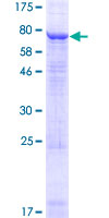 KCNV1 / Kv8.1 Protein - 12.5% SDS-PAGE of human KCNV1 stained with Coomassie Blue