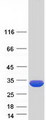 KCTD1 Protein - Purified recombinant protein KCTD1 was analyzed by SDS-PAGE gel and Coomassie Blue Staining