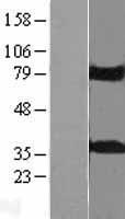 KCTD10 Protein - Western validation with an anti-DDK antibody * L: Control HEK293 lysate R: Over-expression lysate