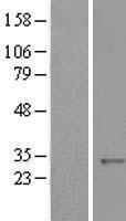 KCTD11 Protein - Western validation with an anti-DDK antibody * L: Control HEK293 lysate R: Over-expression lysate