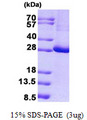 KCTD11 Protein
