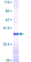 KCTD13 Protein - 12.5% SDS-PAGE Stained with Coomassie Blue.