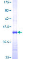 KCTD13 Protein - 12.5% SDS-PAGE Stained with Coomassie Blue.