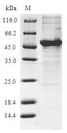 KCTD15 Protein - (Tris-Glycine gel) Discontinuous SDS-PAGE (reduced) with 5% enrichment gel and 15% separation gel.