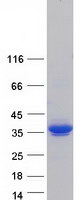 KCTD15 Protein - Purified recombinant protein KCTD15 was analyzed by SDS-PAGE gel and Coomassie Blue Staining