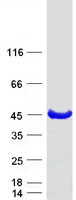 KCTD17 Protein - Purified recombinant protein KCTD17 was analyzed by SDS-PAGE gel and Coomassie Blue Staining