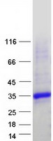 KCTD2 Protein - Purified recombinant protein KCTD2 was analyzed by SDS-PAGE gel and Coomassie Blue Staining