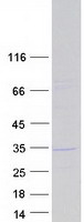 KCTD21 Protein - Purified recombinant protein KCTD21 was analyzed by SDS-PAGE gel and Coomassie Blue Staining