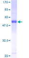 KCTD4 Protein - 12.5% SDS-PAGE of human KCTD4 stained with Coomassie Blue