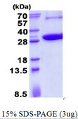 KCTD5 Protein