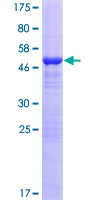 KCTD6 Protein - 12.5% SDS-PAGE of human KCTD6 stained with Coomassie Blue