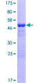 KCTD6 Protein - 12.5% SDS-PAGE of human KCTD6 stained with Coomassie Blue