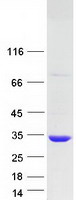 KCTD6 Protein - Purified recombinant protein KCTD6 was analyzed by SDS-PAGE gel and Coomassie Blue Staining