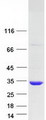 KCTD6 Protein - Purified recombinant protein KCTD6 was analyzed by SDS-PAGE gel and Coomassie Blue Staining