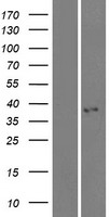 KCTD7 Protein - Western validation with an anti-DDK antibody * L: Control HEK293 lysate R: Over-expression lysate