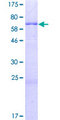 KCTD7 Protein - 12.5% SDS-PAGE of human KCTD7 stained with Coomassie Blue