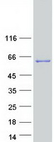 KCTD8 Protein - Purified recombinant protein KCTD8 was analyzed by SDS-PAGE gel and Coomassie Blue Staining