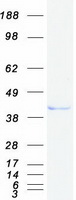 KCTD9 Protein - Purified recombinant protein KCTD9 was analyzed by SDS-PAGE gel and Coomassie Blue Staining