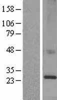 KDELR1 / HDEL Protein - Western validation with an anti-DDK antibody * L: Control HEK293 lysate R: Over-expression lysate