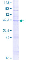 KDELR2 Protein - 12.5% SDS-PAGE of human KDELR2 stained with Coomassie Blue