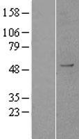 KDM1B Protein - Western validation with an anti-DDK antibody * L: Control HEK293 lysate R: Over-expression lysate