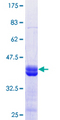 KDM2B / FBXL10 Protein - 12.5% SDS-PAGE Stained with Coomassie Blue.