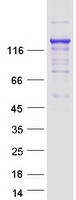 KDM3A / JMJD1A Protein - Purified recombinant protein KDM3A was analyzed by SDS-PAGE gel and Coomassie Blue Staining