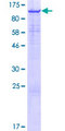 KDM3B / JMJD1B Protein - 12.5% SDS-PAGE of human JMJD1B stained with Coomassie Blue