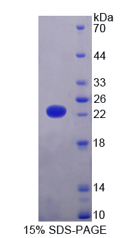 KDM4A / JHDM3A / JMJD2A Protein - Recombinant  Lysine Specific Demethylase 4A By SDS-PAGE