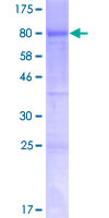 KDM4D / JMJD2D Protein - 12.5% SDS-PAGE of human JMJD2D stained with Coomassie Blue