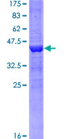 KDM5A / JARID1A Protein