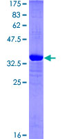 KDM5B / JARID1B Protein - 12.5% SDS-PAGE Stained with Coomassie Blue.
