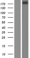 KDM5D / JARID1D Protein - Western validation with an anti-DDK antibody * L: Control HEK293 lysate R: Over-expression lysate