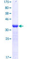 KDM6A / UTX Protein - 12.5% SDS-PAGE Stained with Coomassie Blue.