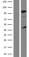 KDM7A / JHDM1D Protein - Western validation with an anti-DDK antibody * L: Control HEK293 lysate R: Over-expression lysate