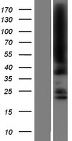 KDM8 / JMJD5 / FLJ13798 Protein - Western validation with an anti-DDK antibody * L: Control HEK293 lysate R: Over-expression lysate