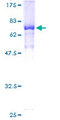 KDM8 / JMJD5 / FLJ13798 Protein - 12.5% SDS-PAGE of human FLJ13798 stained with Coomassie Blue