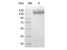 KDR / VEGFR2 / FLK1 Protein - Human VEGF Receptor 2/VEGF R2/FLK-1/KDR (C-6His-Avi) Biotinylated