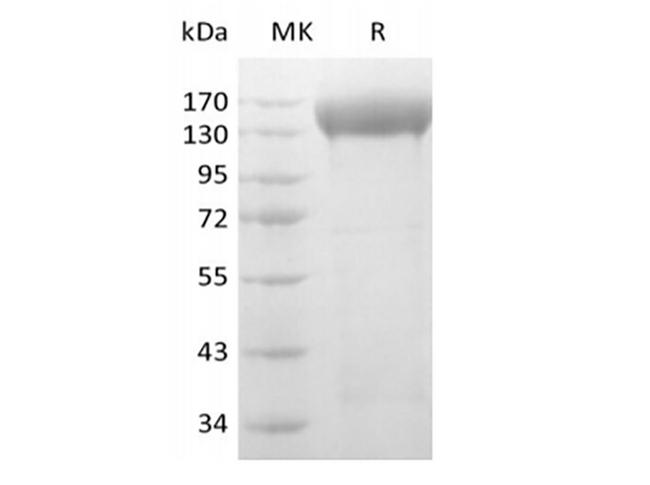 KDR / VEGFR2 / FLK1 Protein - Human VEGF Receptor 2/VEGF R2/FLK-1/KDR (C-6His-Avi) Biotinylated