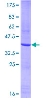 KDR / VEGFR2 / FLK1 Protein - 12.5% SDS-PAGE Stained with Coomassie Blue.
