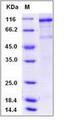 KDR / VEGFR2 / FLK1 Protein