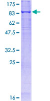 KEAP1 Protein - 12.5% SDS-PAGE of human KEAP1 stained with Coomassie Blue