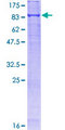 KEAP1 Protein - 12.5% SDS-PAGE of human KEAP1 stained with Coomassie Blue
