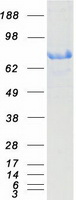 KEAP1 Protein - Purified recombinant protein KEAP1 was analyzed by SDS-PAGE gel and Coomassie Blue Staining