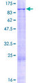 KEL / CD238 Protein - 12.5% SDS-PAGE of human KEL stained with Coomassie Blue