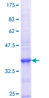 KEL / CD238 Protein - 12.5% SDS-PAGE Stained with Coomassie Blue.