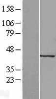KERA / Keratocan Protein - Western validation with an anti-DDK antibody * L: Control HEK293 lysate R: Over-expression lysate