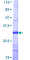 KERA / Keratocan Protein - 12.5% SDS-PAGE Stained with Coomassie Blue.
